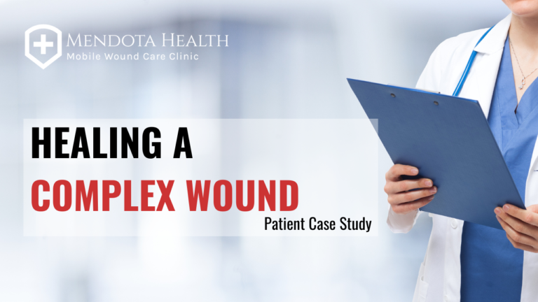 Healing A Complex Wound Mendota Health