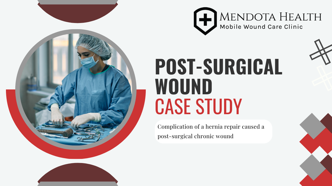 Medical provider prepping surgery equipment. Post-surgical wound case study.