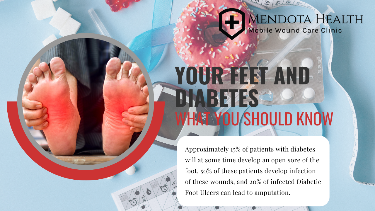 your feet and diabetes with picture of sore feet